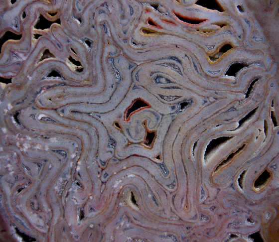 Psaronius brasiliensis