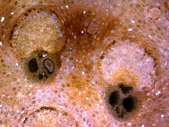 Fibrovascular Bundles and Fibrous Bundles