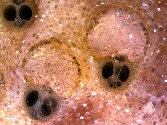 Palm Fibrovascular Bundles