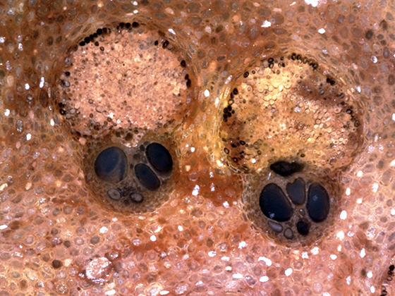 Fibrovascular Bundle