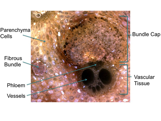 Fibrovascular Bundle Labeled