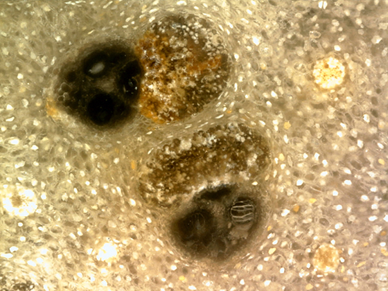 Vascular Bundles in Palm