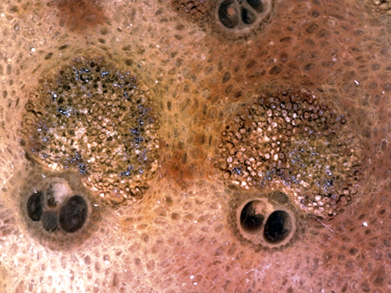 Palmoxylon Vascular Bundles