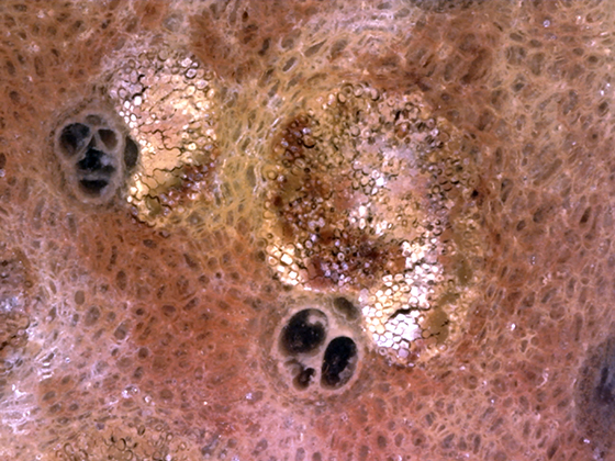 Palmoxylon Vascular Bundles
