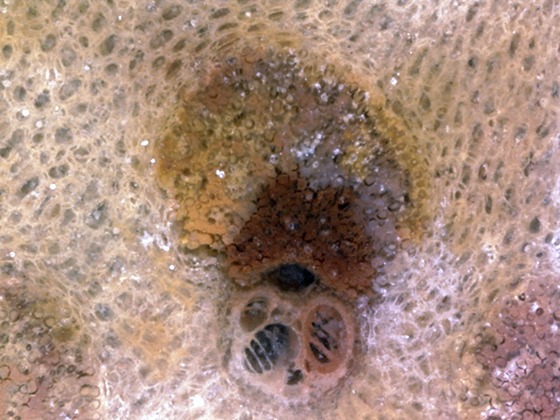 Scalariform Perforation Plates