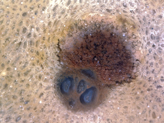 Palm Vascular Bundle