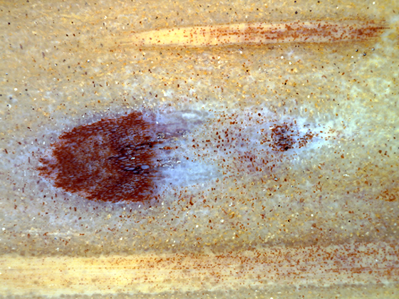 Vascular Bundle Oblique Angle